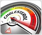 Low and high HDL cholesterol linked to higher risk of infectious disease