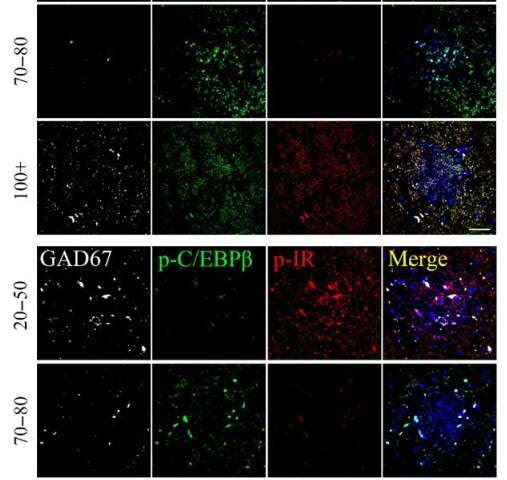 C/EBPβ/AEP pathway dictates both Alzheimer's disease and longevity: Study