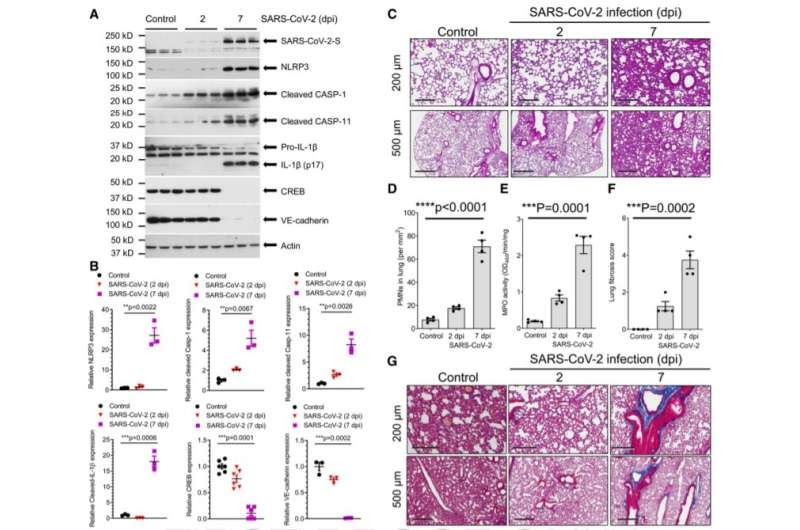 Mitigating lung damage, mortality due to SARS-CoV-2