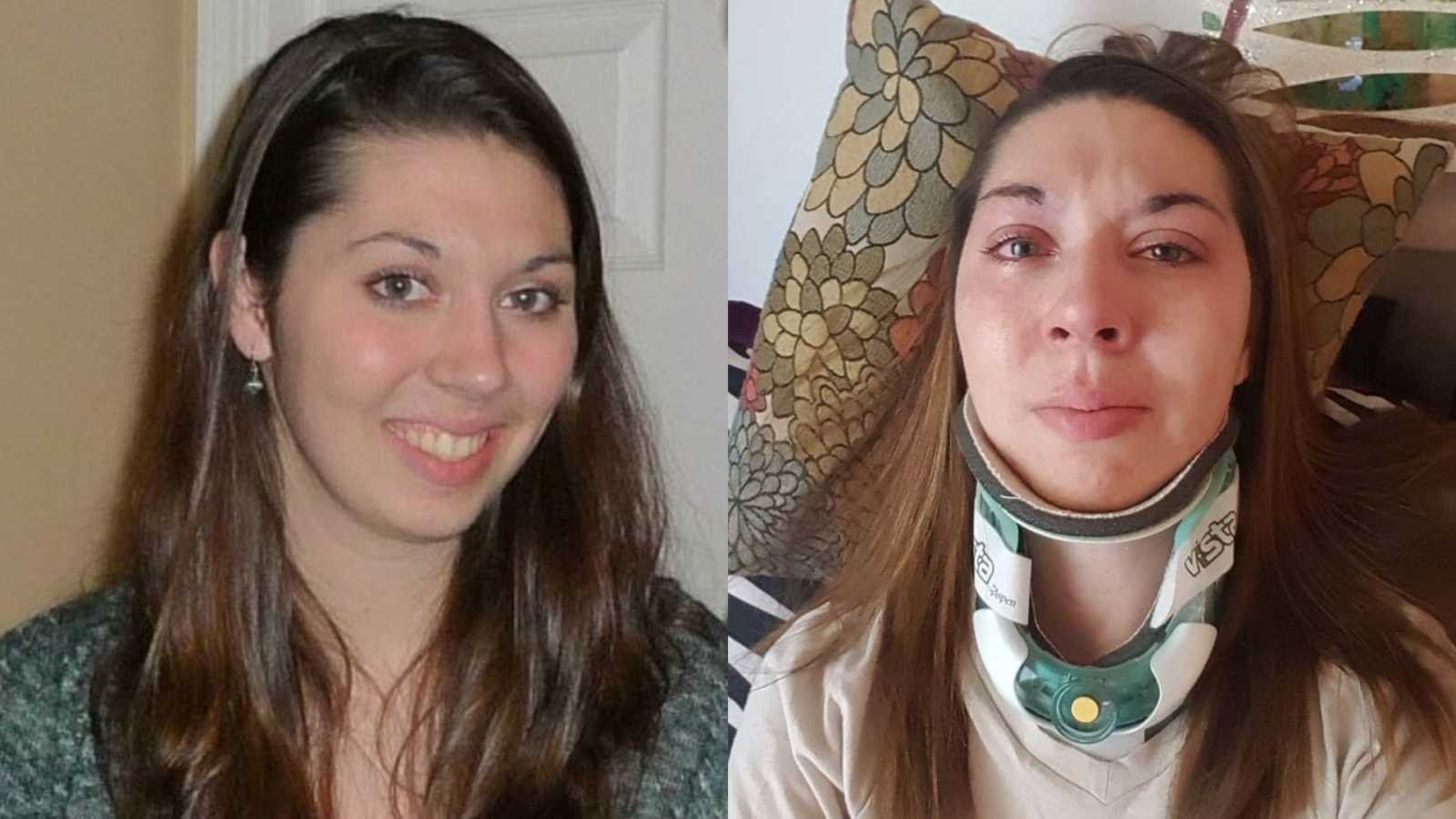 Two photos of Megan, a woman with long brown hair. On the left, Megan smiles. On the right, she wears a neck brace and cries.