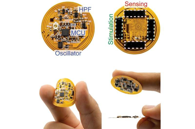 Wireless smart bandage provides new insights on healing chronic wounds