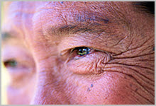 A closeup of aging skin on someone's face.