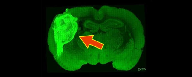 Rat Brain With Human Organoid