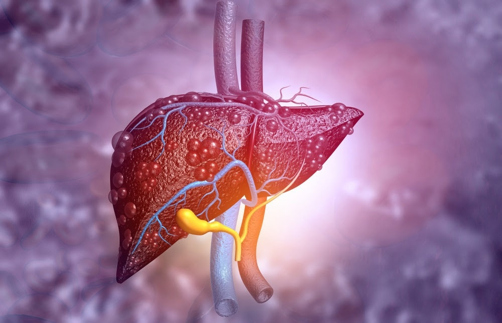 Study: Treatment of Obesity and Metabolic-Associated Fatty Liver Disease with a Diet or Orlistat: A Randomized Controlled Trial. Image Credit: Explode/Shutterstock