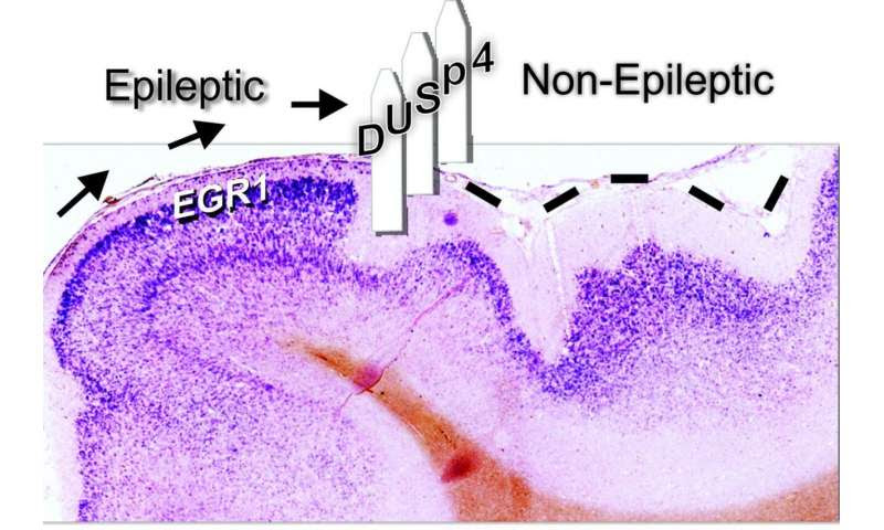 Inhibiting epileptic activity in the brain