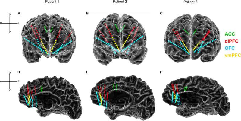 Progress in unlocking the brain's 'code' for depression