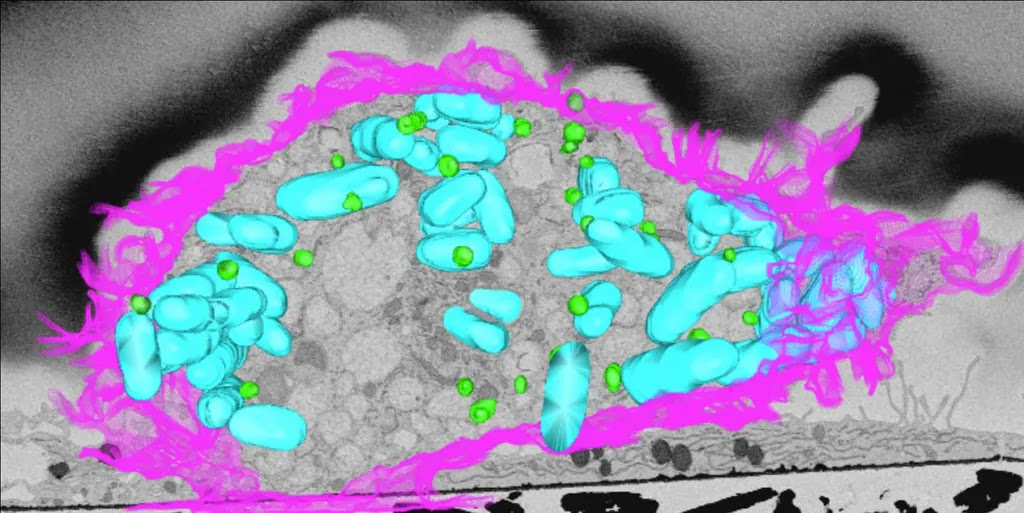 The body fires 'blobs of fat' packed with toxic proteins to fight bacteria