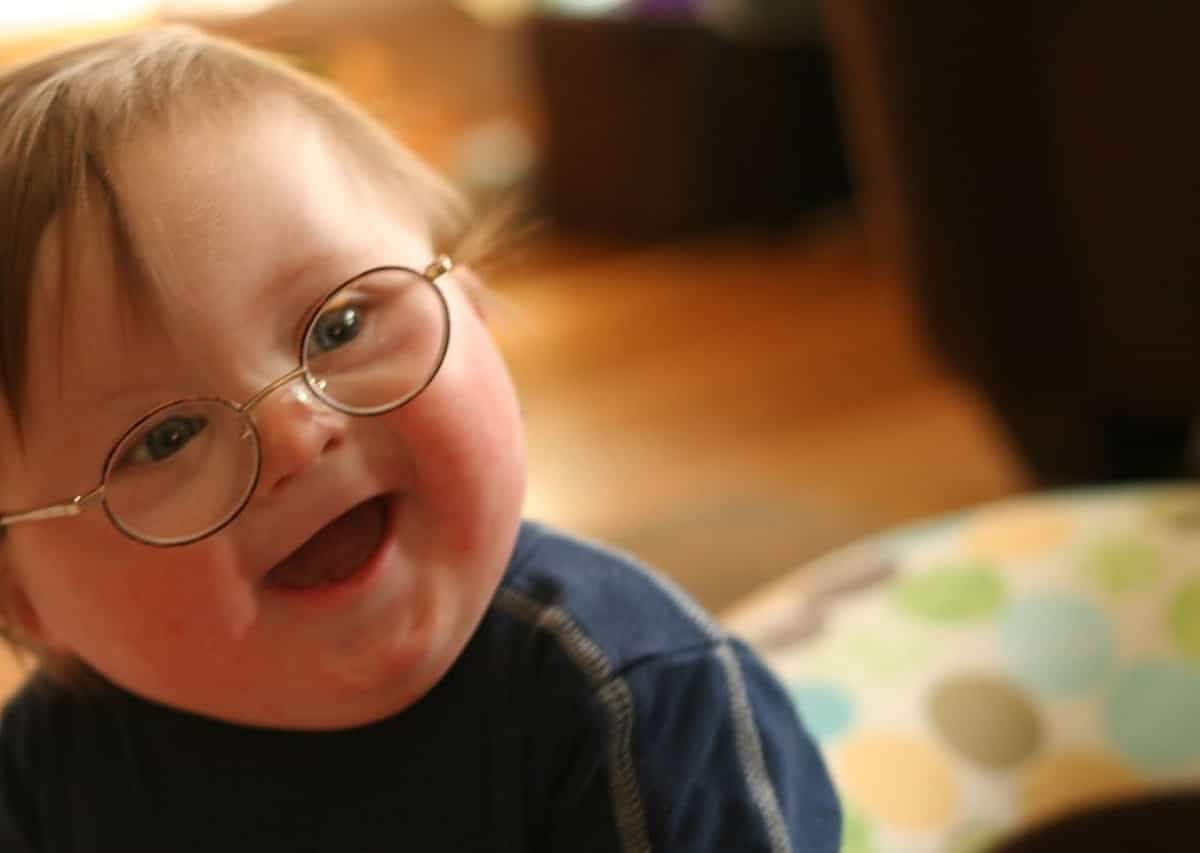 la sindrome di Down: genetico non vuol dire ereditario