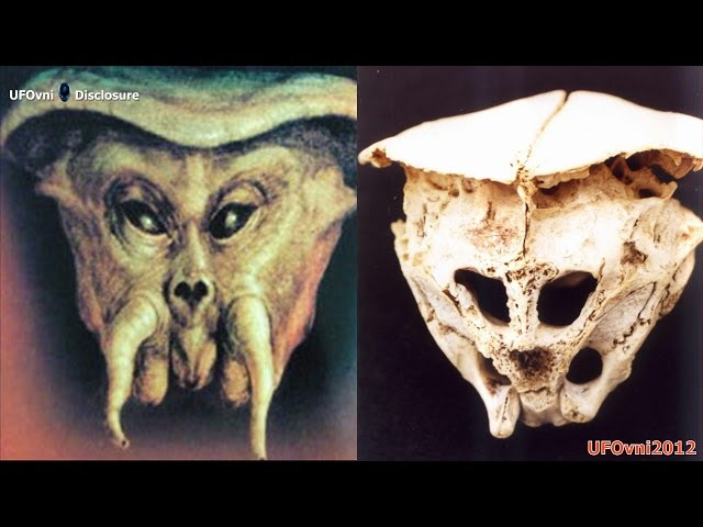 The Rhodope Skull: Skull Was it a True ALIEN ?  Sddefault