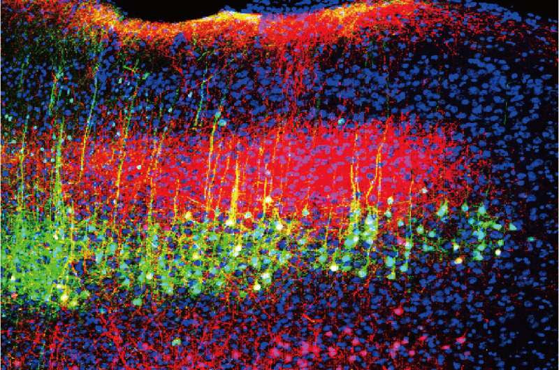 Researchers discover how sound reduces pain in mice