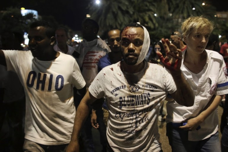 A wounded Israeli of Ethiopian origin during a protest against racism in Tel Aviv [EPA]