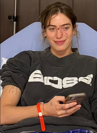 Actress Clara McGregor shows up on red carpet with bloodied face after she was attacked by dog