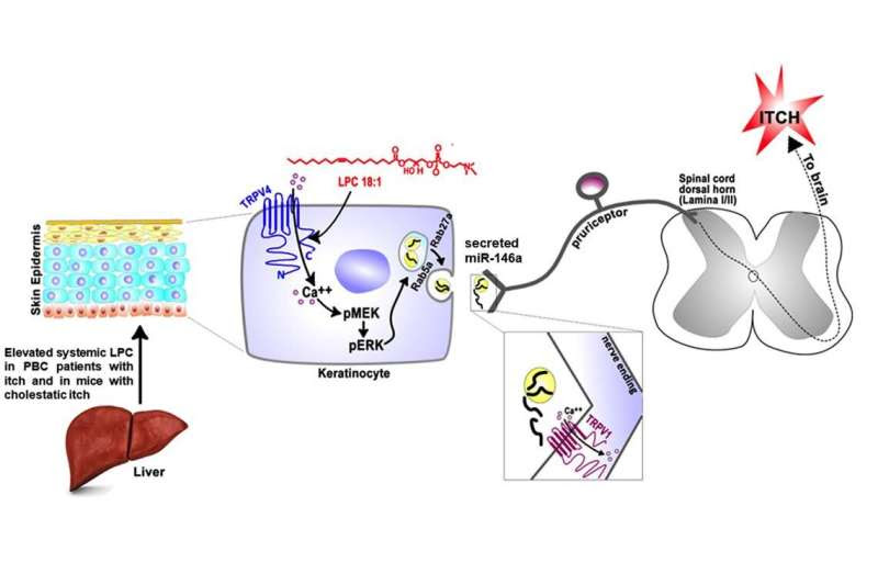 Maddening itch of liver disease comes from a surprising source