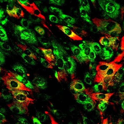 Using CRISPR-interference and single-cell transcriptomics to systematically examine inflammatory reactive states